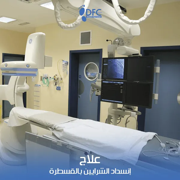 علاج انسداد الشرايين بالقسطرة