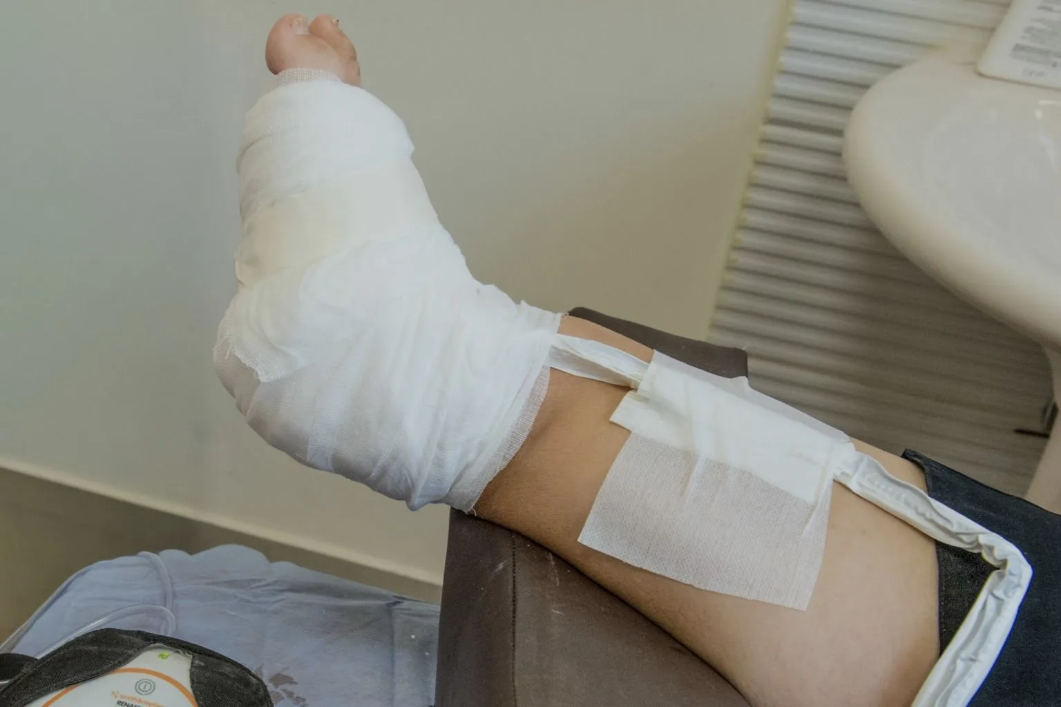 علاج قرح القدم السكرى بالفاكيوم